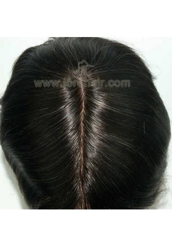 jq1307 hair replacement system